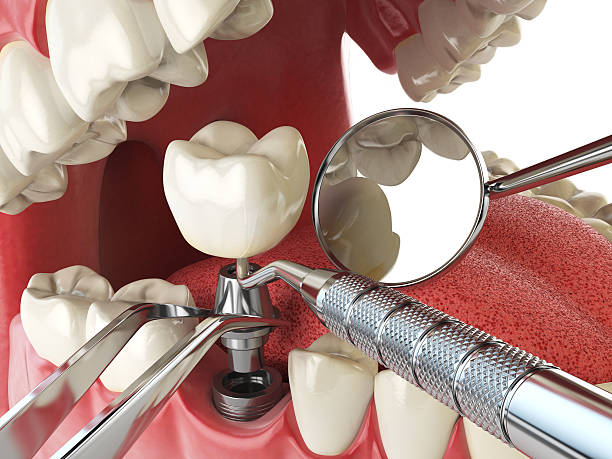 Best Emergency Wisdom Teeth Removal in Holiday Heights, NJ